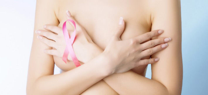 Breast cancer