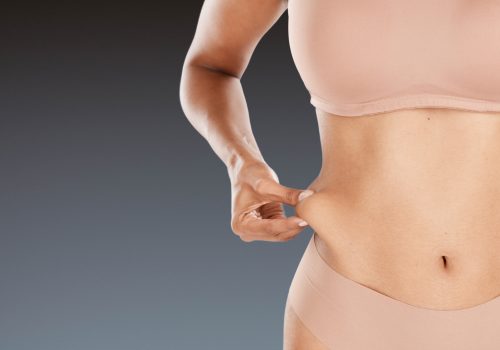 Liposuction for stubborn fat